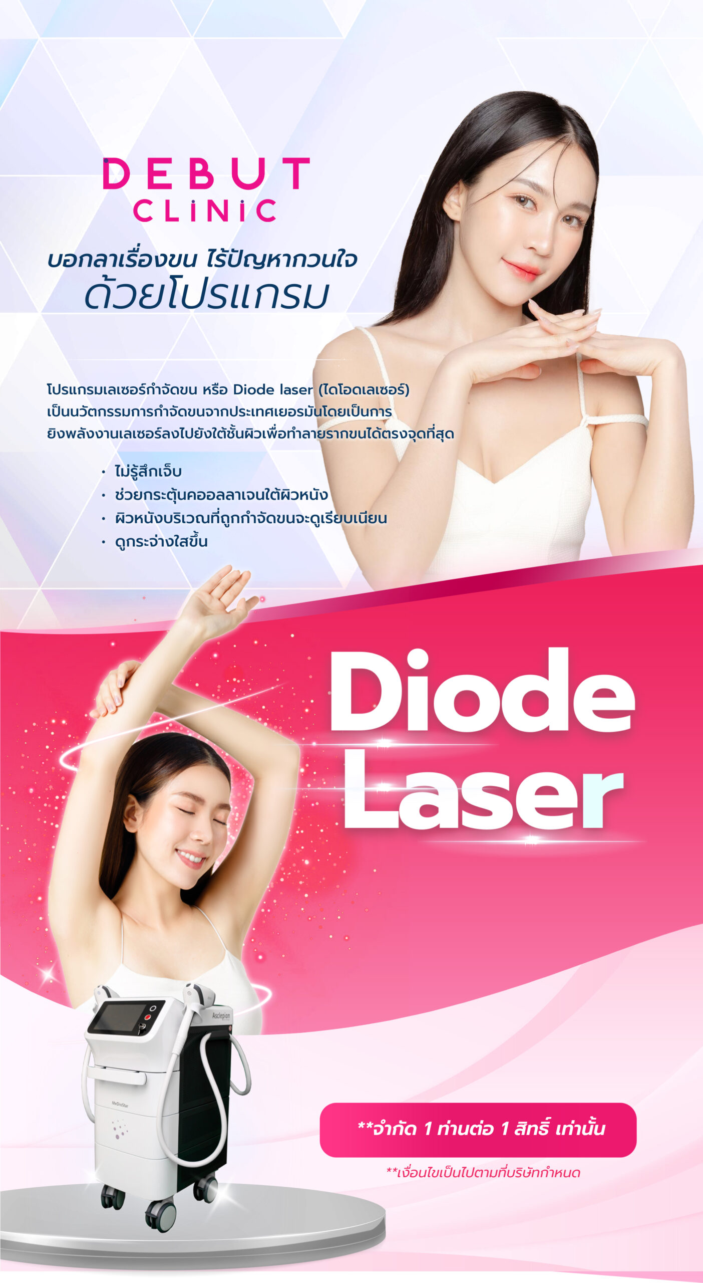 Diode Laser